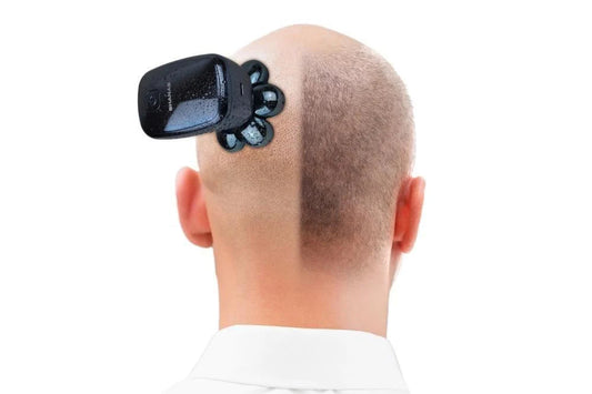 Baldness Trimmer